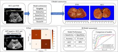 Deep Learning for Approaching Hepatocellular Carcinoma Ultrasound Screening Dilemma: Identification of α-Fetoprotein-Negative Hepatocellular Carcinoma From Focal Liver Lesion Found in High-Risk Patients